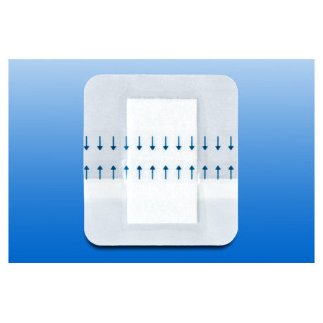 RUDAFILM-steril Verbandpfl.30x10 cm transp. - 50 Stück